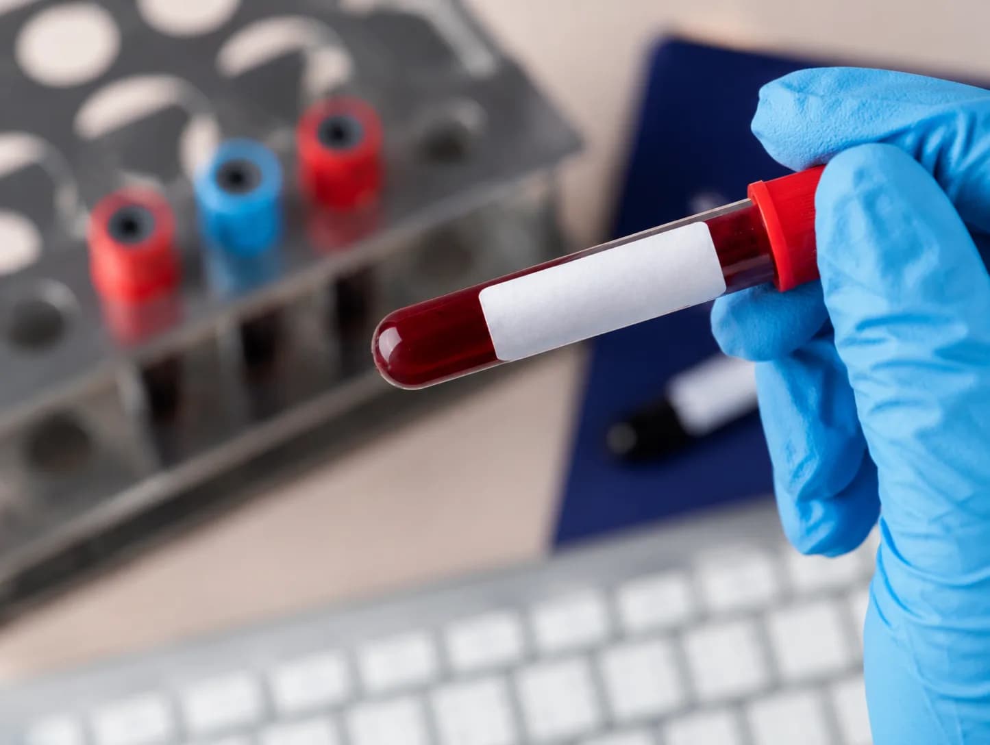 In-House Blood Bank